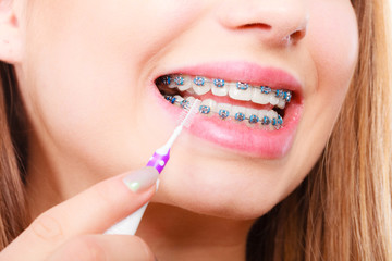 Woman brushing teeth with braces using brush