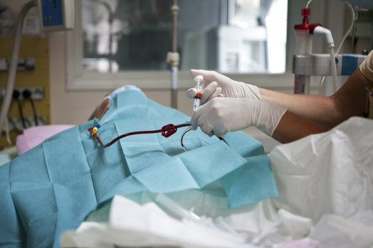 HEMODIALYSIS