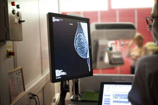 MAMMOGRAPHY EXAMINATION
