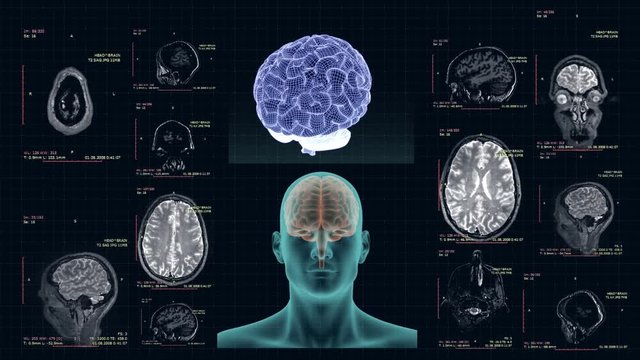 MRI of the human brain in different projections, high-tech concept
