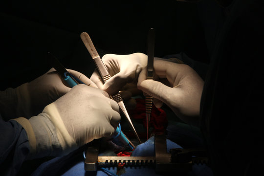 HEART SURGERY