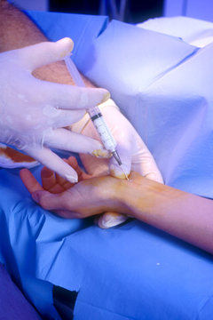WRIST, INFILTRATION