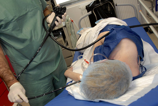 DIGESTIVE ENDOSCOPY