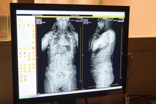 PEDIATRIC ORTHOPEDICS