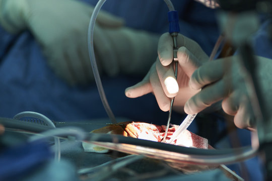 PEDIATRIC NEUROSURGERY 