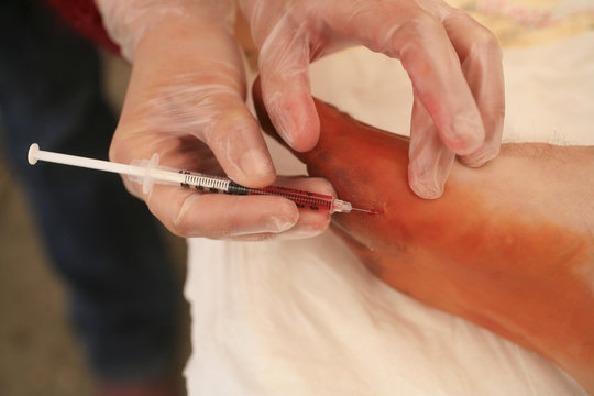 SPORTS MEDICINE