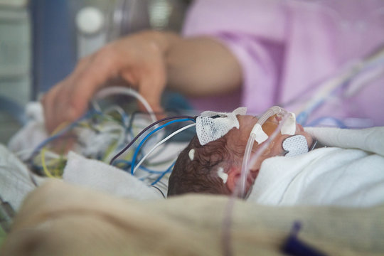 Close-up of nurse attaching electrodes to baby's scalp in incubator