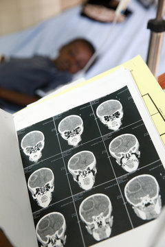 Hospital. sick child. scanner.