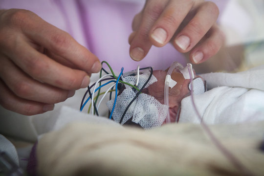 NEONATOLOGY