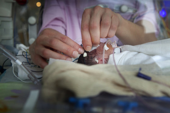 NEONATOLOGY