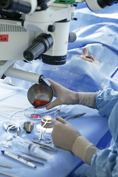 CORNEAL TRANSPLANT