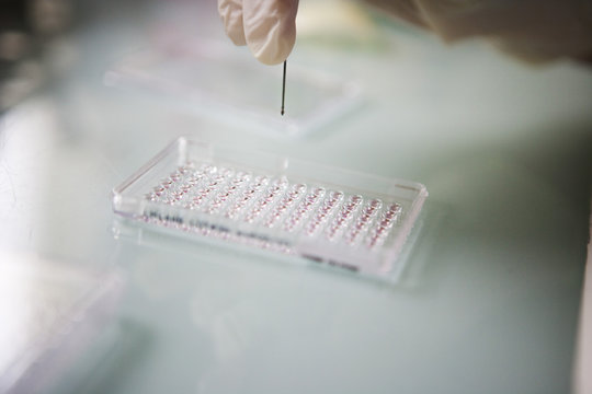 BLOOD ANALYSIS