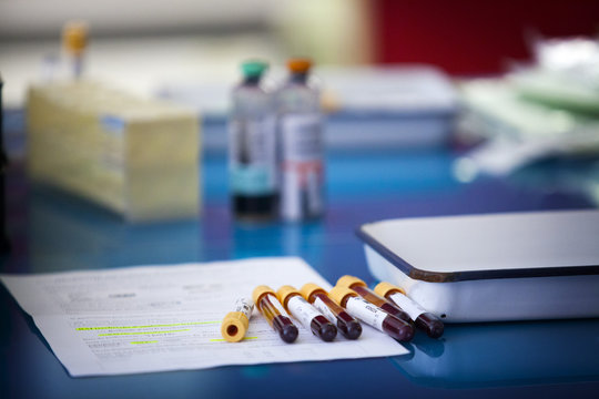 ANALYSIS LABORATORY