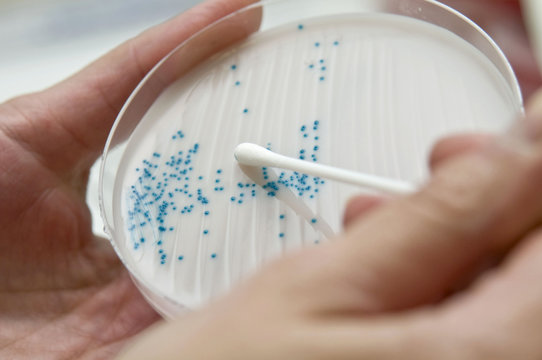 PETRI DISH