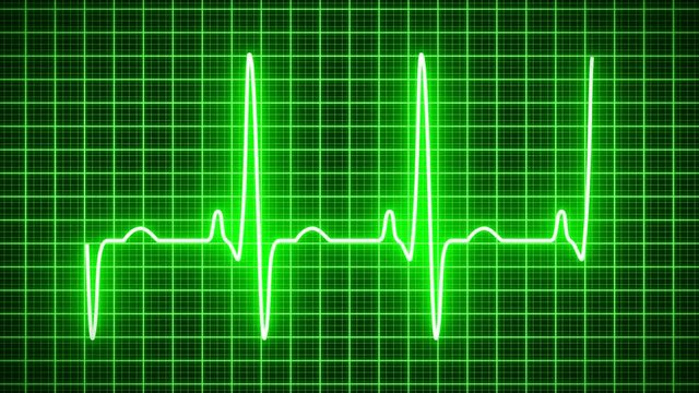 EKG - Elektrokardiogramm - Herzschlag - Herzstillstand - Monitor