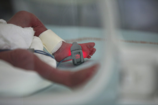 FOOT OF PREMATURE BABY