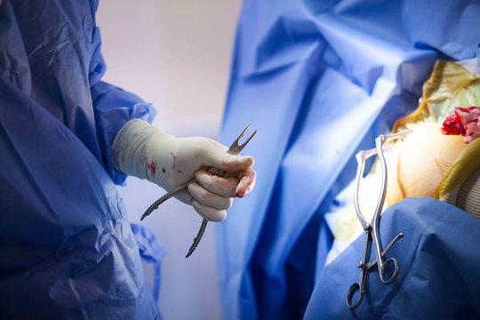 ORTHOPEDIC SURGERY