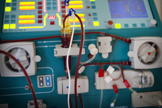 HEMODIALYSIS