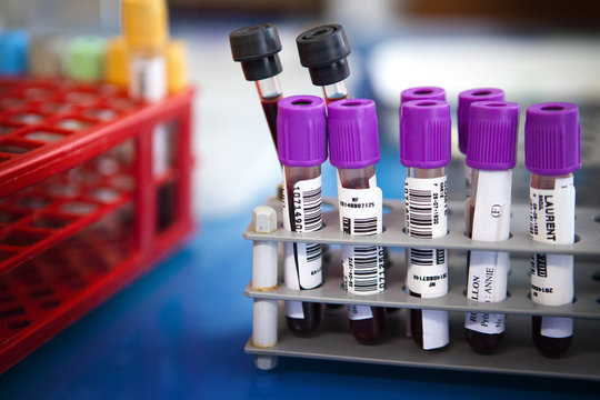 ANALYSIS LABORATORY
