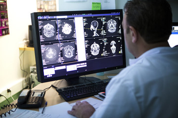 Radiologist examining the brain scans on monitor