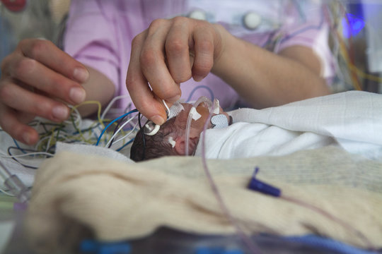 NEONATOLOGY