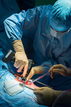 HIP PROSTHESIS, SURGERY