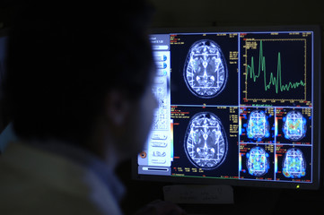 Radiologist examining the brain scans on monitor