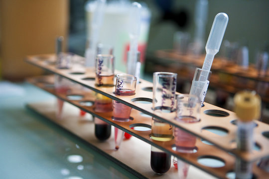 BLOOD ANALYSIS