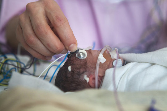 NEONATOLOGY