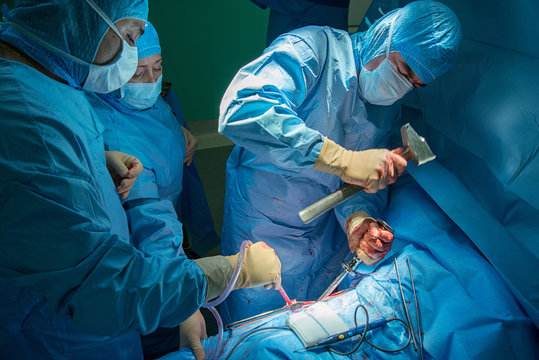 HIP PROSTHESIS, SURGERY
