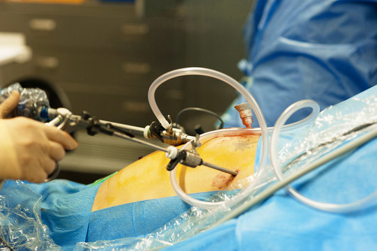 GYNECOLOGICAL SURGERY