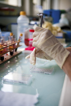 BLOOD ANALYSIS