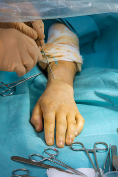 ORTHOPEDIC SURGERY
