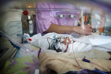 Close-up of nurse attaching electrodes to baby's scalp in incubator