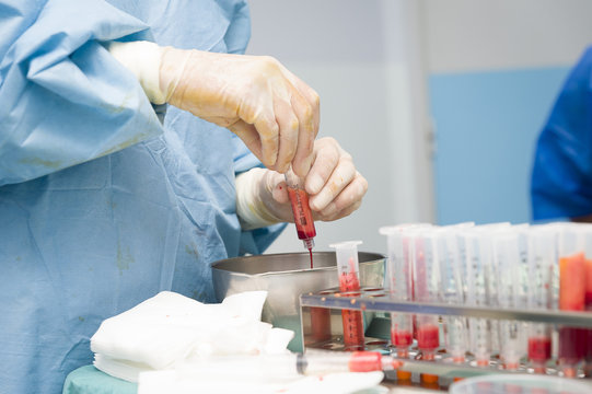 LIPOFILLING