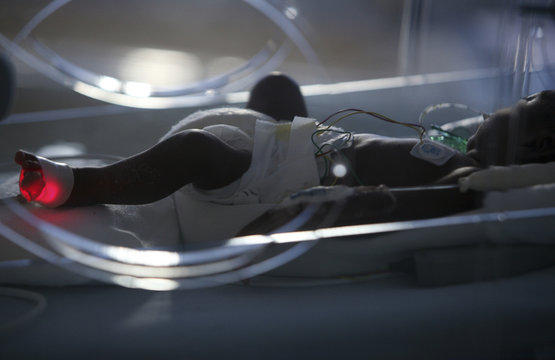 PREMATURE BABY