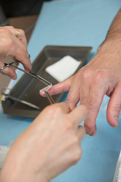 PARONYCHIA CARE