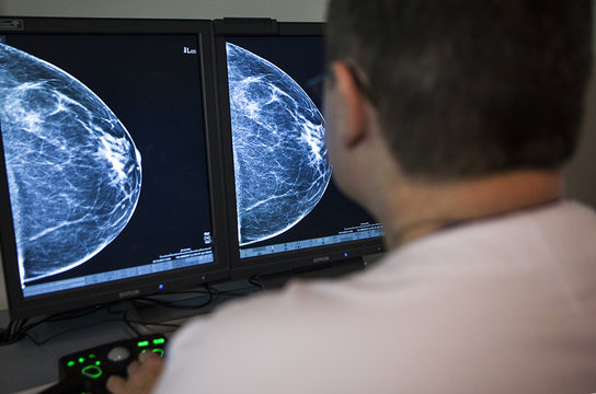 MAMMOGRAPHY EXAMINATION