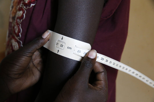 Refugee camp. malnutrition prevention program run by concern worldwide.