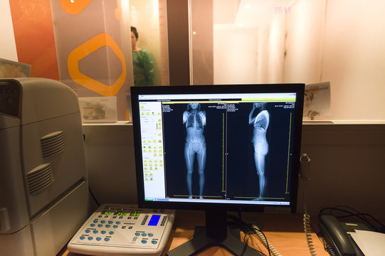 EOS X-RAY IMAGING