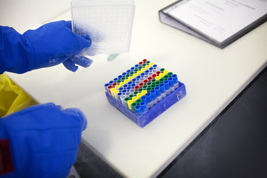 AIDS, RESEARCH