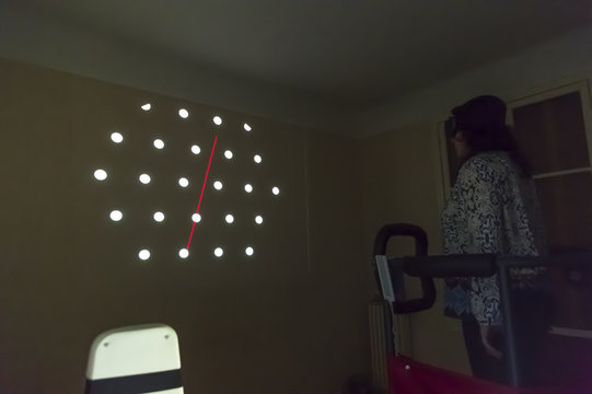 VESTIBULAR REHABILITATION