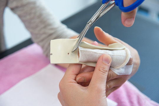 FINGER ORTHOSIS