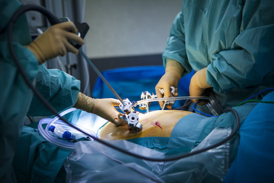 ROBOT-ASSISTED SURGERY