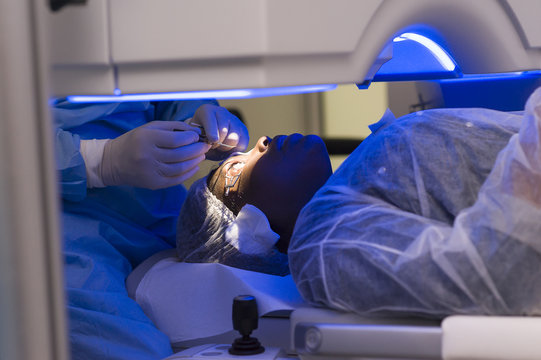 EYE LASER SURGERY