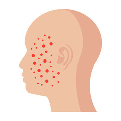 Dermatology concept with rash or pimples on the face, vector illustration in flat style