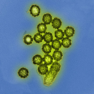 Electron microscope image of H1N1 influenza A