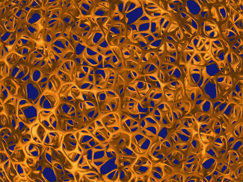 Illustration of moderate osteoporosis of the bone