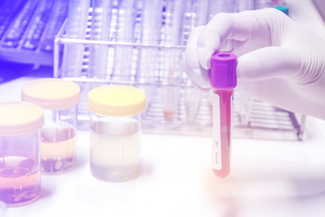 hand holding tube blood sample