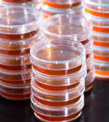 Pile petri dish for growing cultures of microorganisms in doctor hand , fungi and microbes. A Petri dish  ( Petrie dish. Petri plate or cell-culture dish)